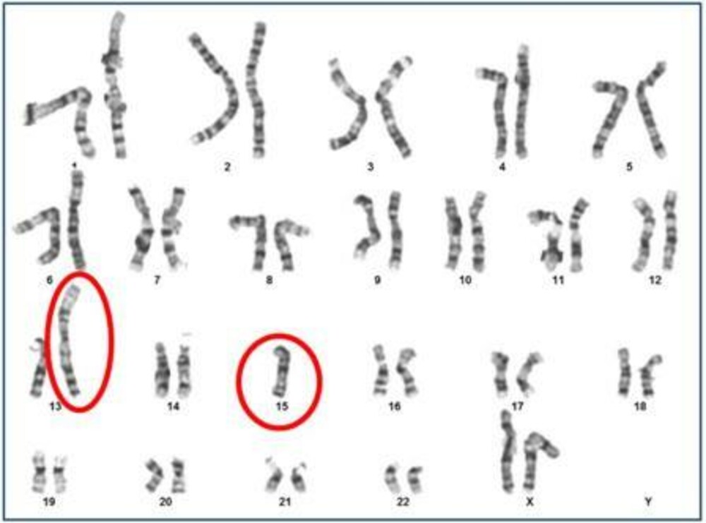 Karyotyping Queensland Fertility Group 2311